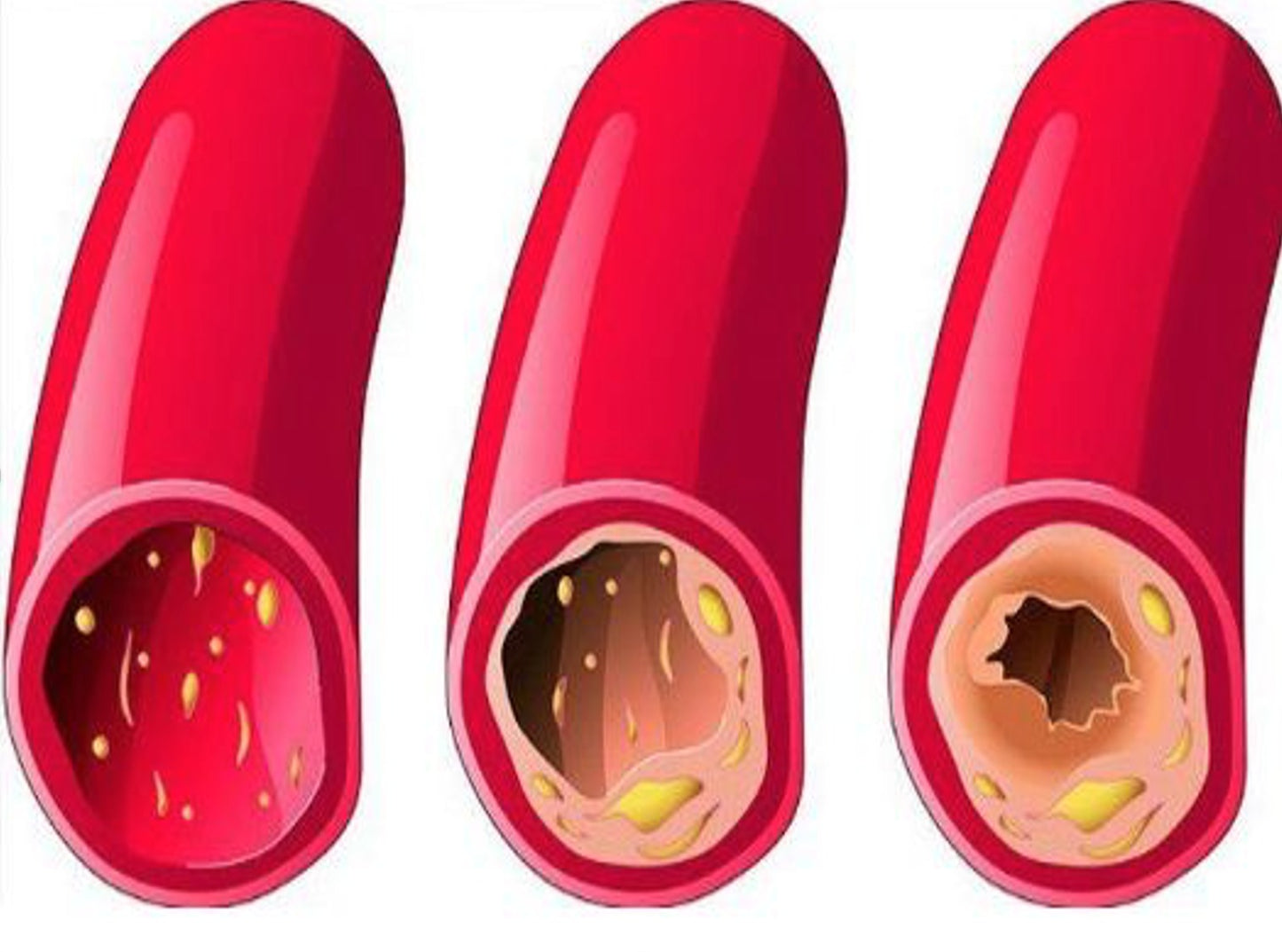 heart supplememts